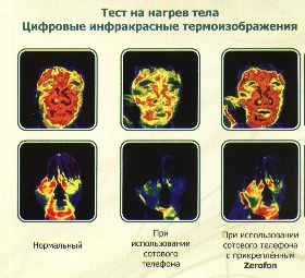 Воздействие сотового телефона на мозг человека